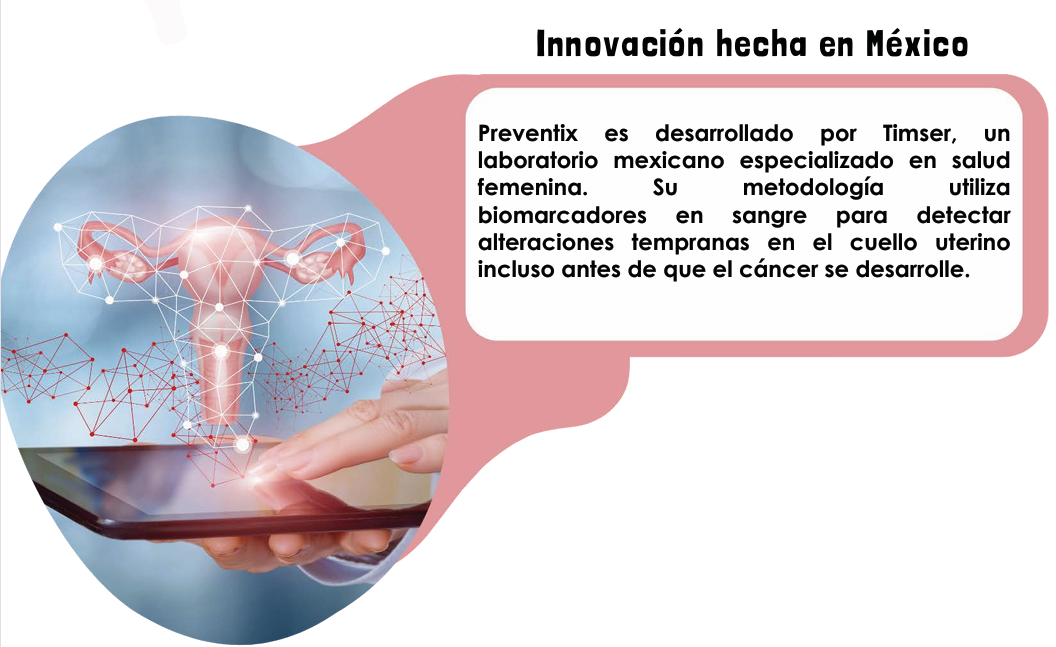 Imagen de Cervix